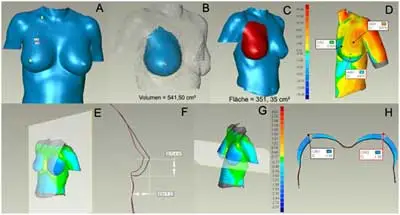 3D Messungen - Dr. Kovacs München