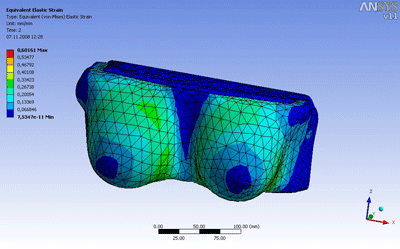 Numerische Simulation - Ästhetisch Plastische Chirurgie - Dr. Kovacs München