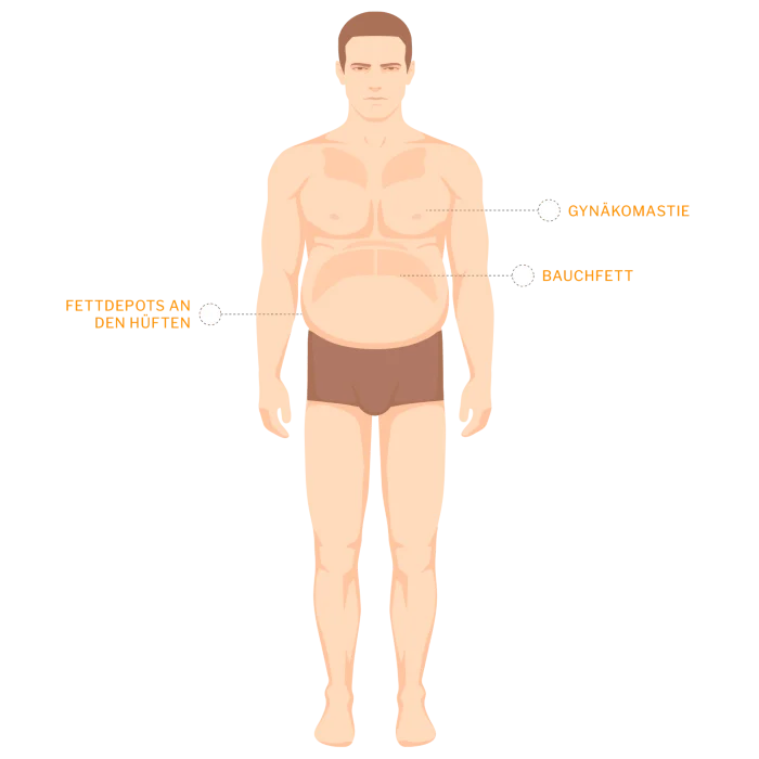 liposuktion mann